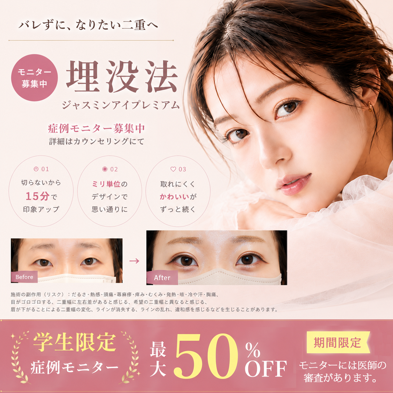 学生限定 二重埋没症例モニター募集 最大50%OFF 期間限定 医師の審査あり
